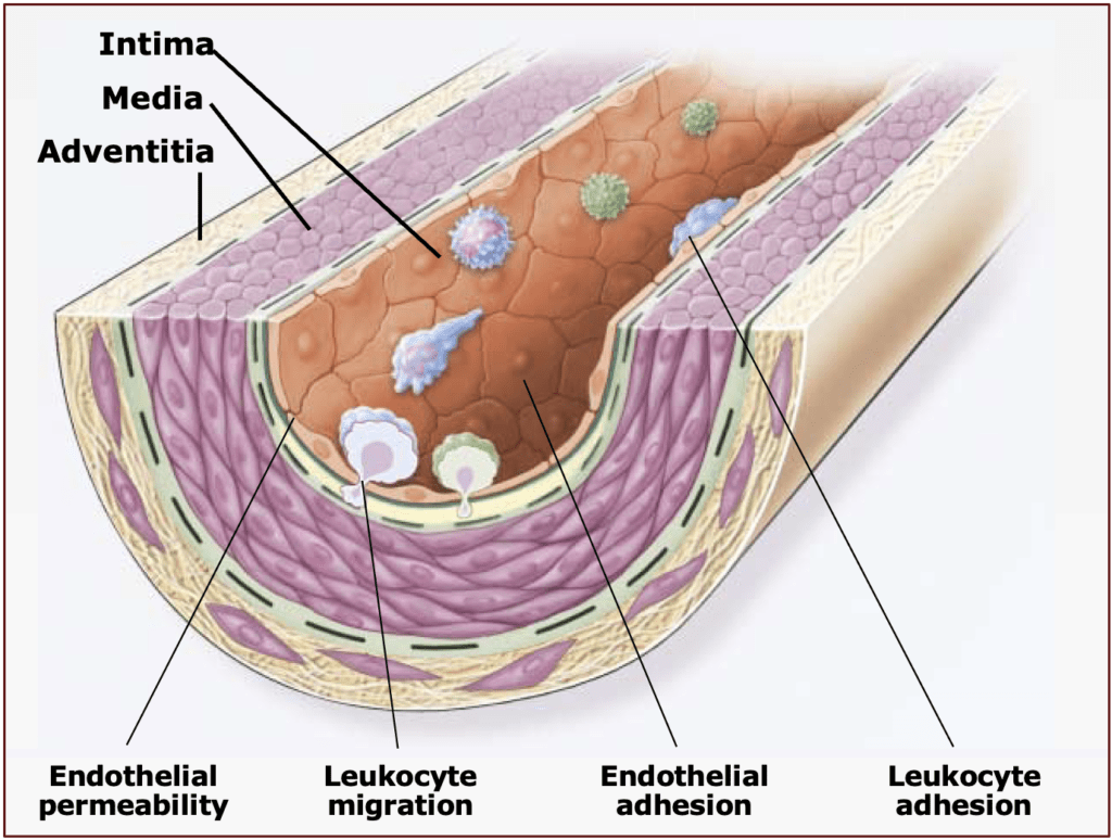 Atherosclerosis early